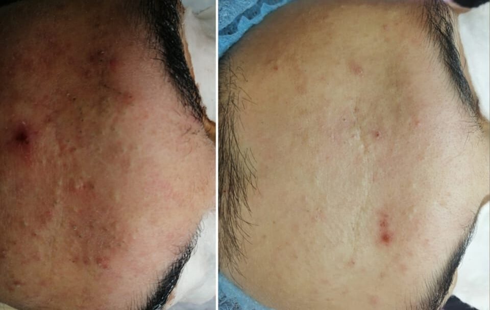 Useful advice for skin care | Kozmerički salon Iris